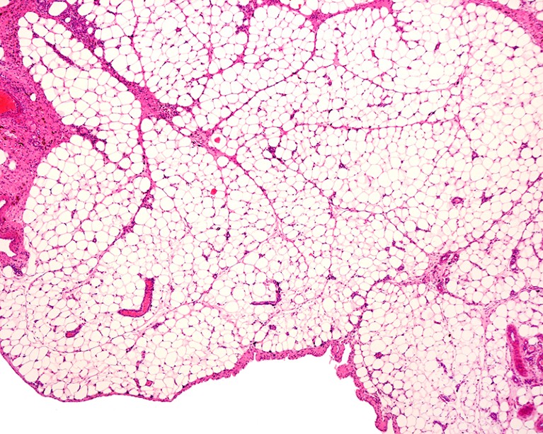 Light micrograph of white adipose tissue, or fat, stained with haematoxylin and eosin.
