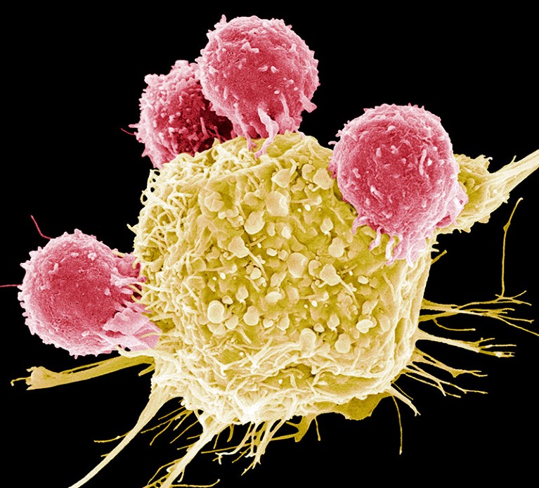 Coloured scanning electron micrograph (SEM) of T lymphocyte cells (pink) attached to a cancer cell.