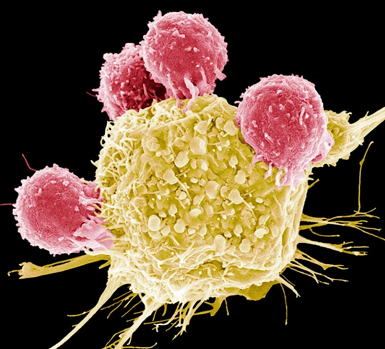 Cutting-edge CAR-T cancer therapy is now made in India — at one-tenth the cost