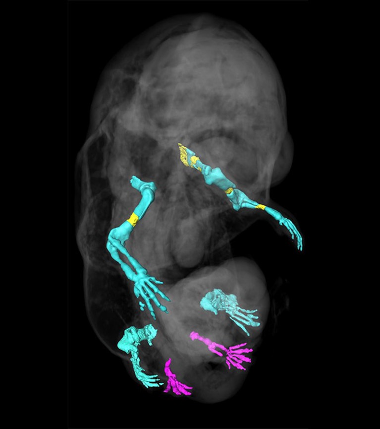 3D reconstruction of the limb skeleton of a Tgfbr1-cKO fetus obtained by OPT and after segmentation of the limb skeleton. Extra hindlimbs are in magenta. Ossification shown in yellow.
