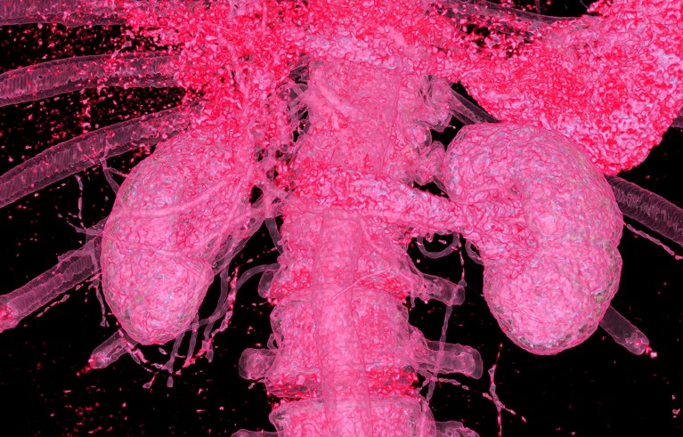 Coloured 3D computed tomography scan of healthy human kidneys.
