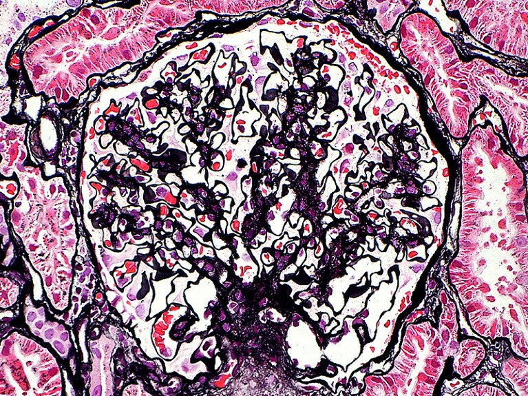Light micrograph of the kidney glomerulus