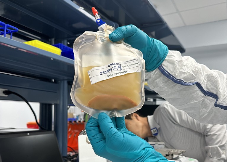 Gloved hands holding up a fluid bag of the donor liver cells in a lab.
