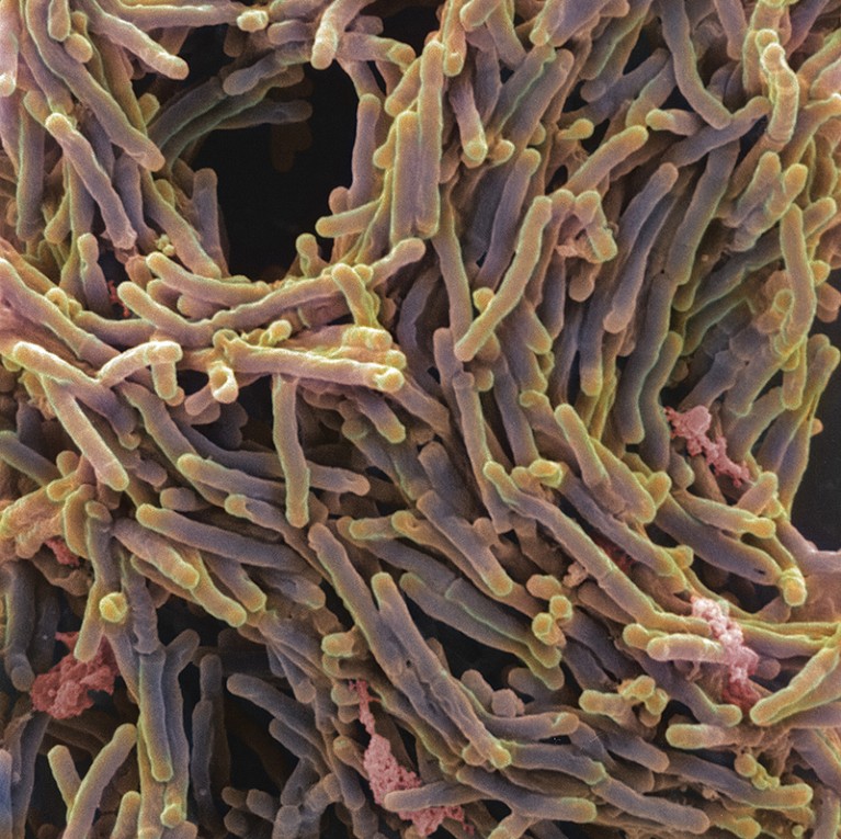 Close-up of bacteria coloured purple and yellow