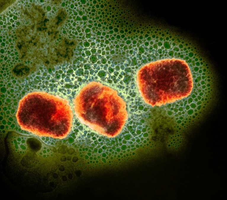 Transmission electron micrograph (TEM) of mpox (previously monkeypox) virus particles.