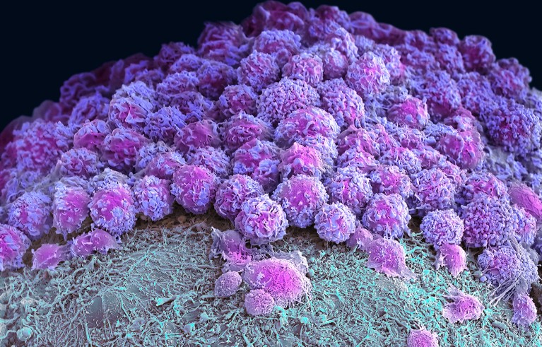 Coloured scanning electron micrograph (SEM) of a neural organoid.