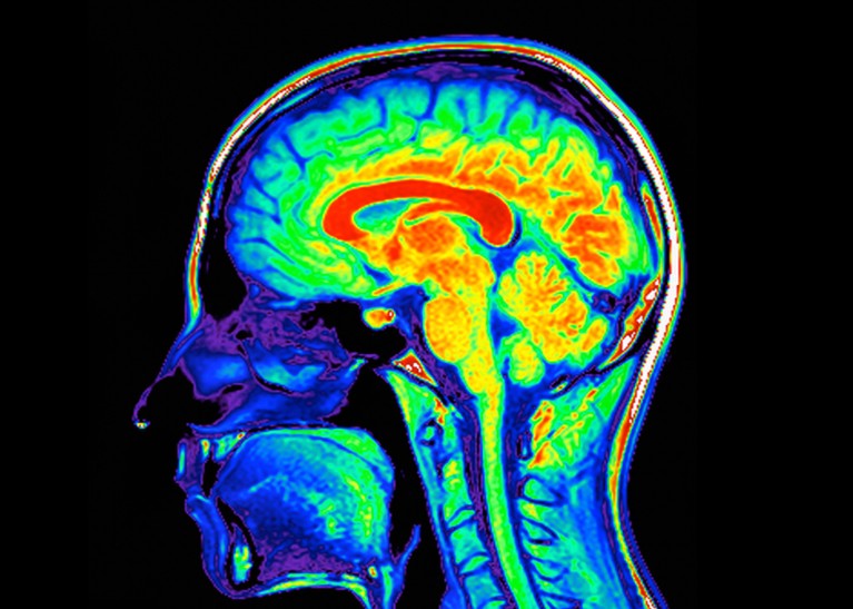 Coloured magnetic resonance imaging (MRI) scan of a sagittal section through a patient's head showing a healthy human brain and brain stem.