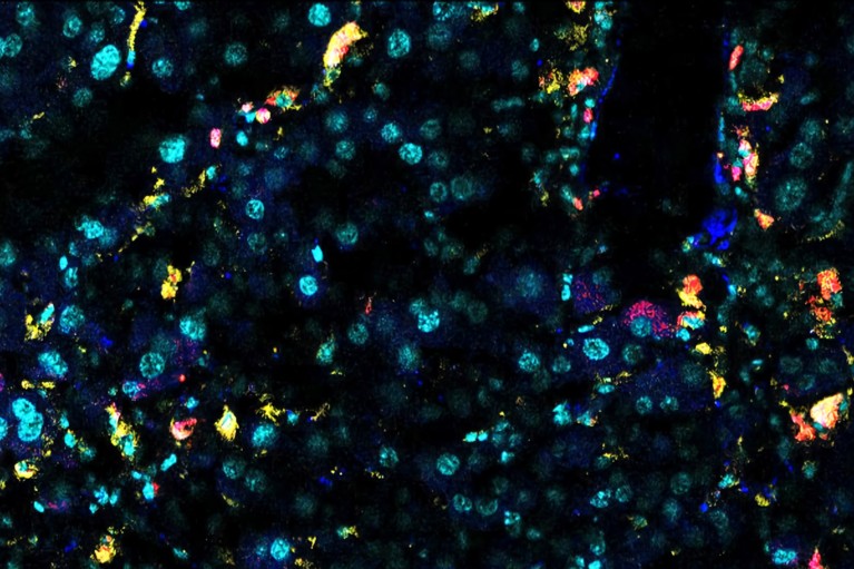 A multi-coloured immunofluorescence image of an aged mouse liver.