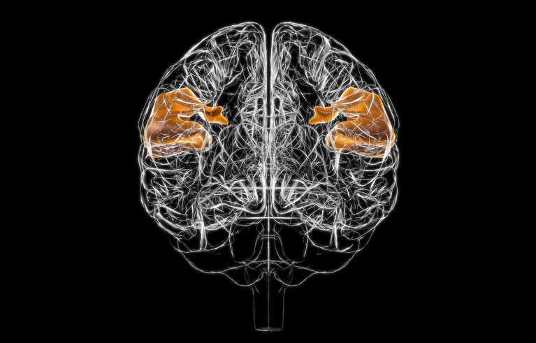 A computer generated illustration of a human brain with the supramarginal gyrus areas highlighted.