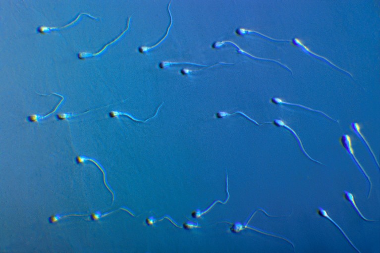 Light micrograph of a field of human sperm with a blue background
