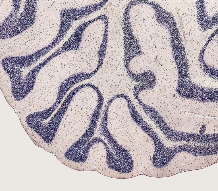 Close up of a cross section of a rat's brain.