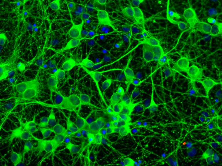 A fluorescence light micrograph of brain hippocampus neurons, shown in green and blue