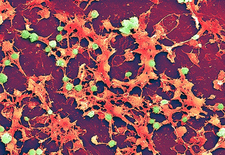 Micrografía electrónica que muestra una gran cantidad de bacterias Staphylococcus aureus en verde y naranja.