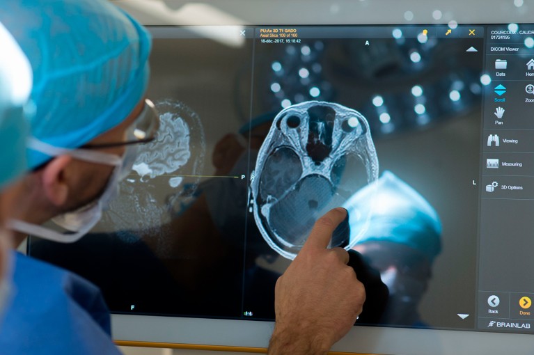 Close-up of a neurosurgeon studying an MRI scan of a brain