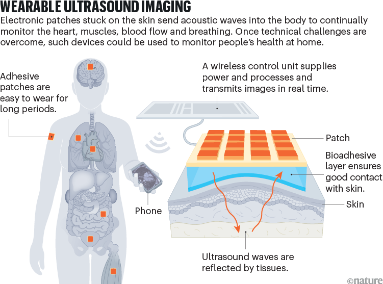 Wearable ultrasound imaging. A graphic showing how adhesive patches interact with the skin and how ultrasound scan images are recorded and transmitted.