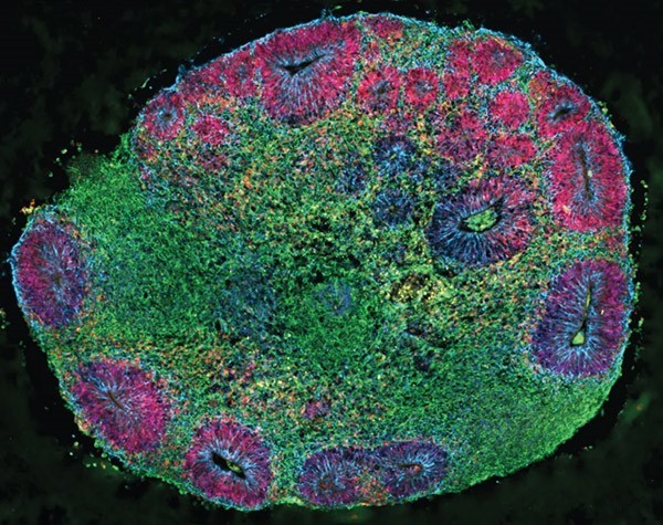 A chimeroid seen in blue, purple, pink and green colours