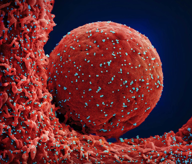 Coloured scanning electron micrograph of a cell (red) infected with the Omicron strain of the SARS-CoV-2 virus particles (blue).