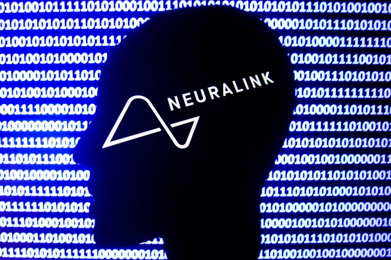 Second brain implant by Elon Musk’s Neuralink: will it fare better than the first? 