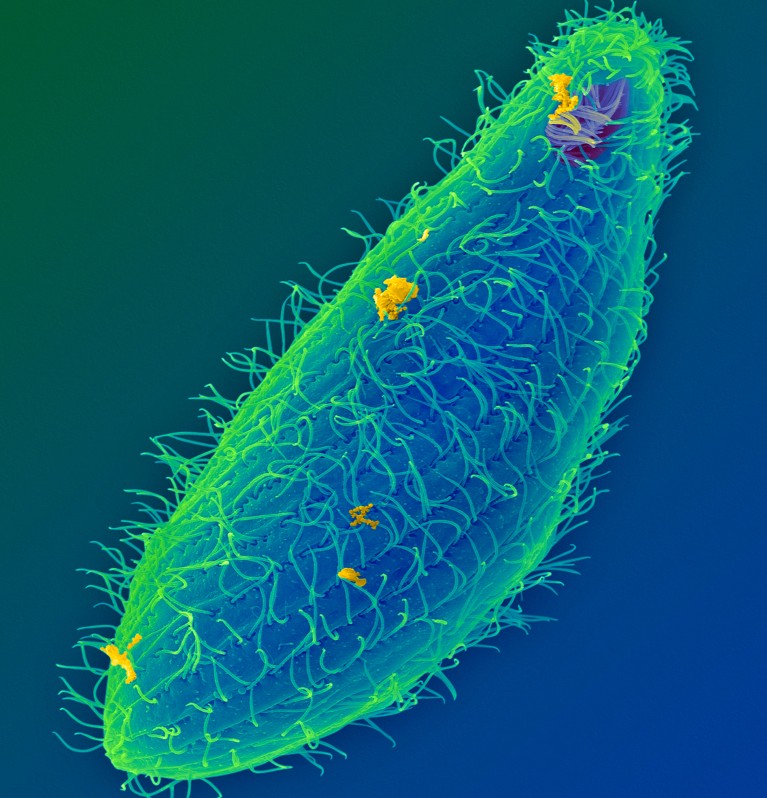 Ciliated protozoan (Tetrahymena thermophila), coloured scanning electron micrograph