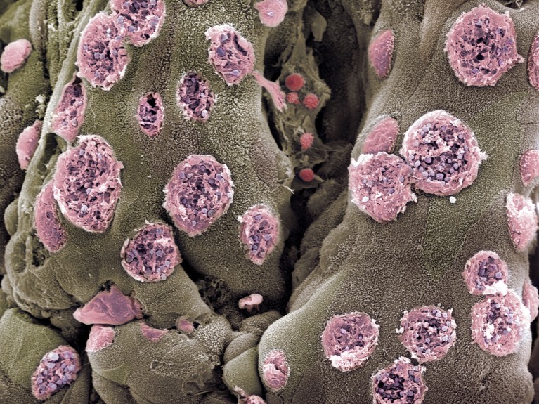 Coloured scanning electron micrograph of round goblet cells shown in pink