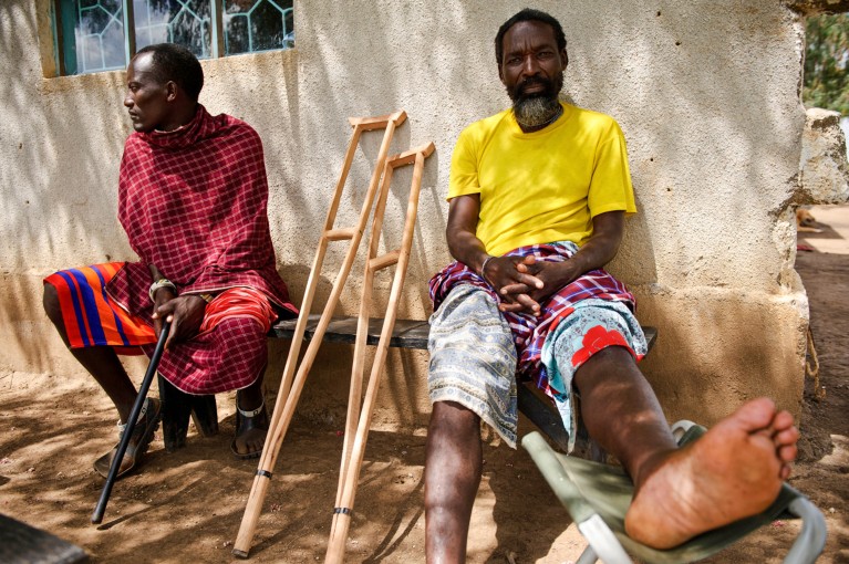 Two patients at a medical centre in Tanzania, one resting his foot on a stool while recovering from a snake bite