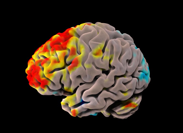 fMRI scan of a healthy human brain at rest shown in red, yellow and blue colours on a black background