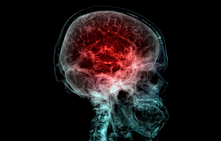 Coloured CT scan highlighting the blood vessels in a human brain.