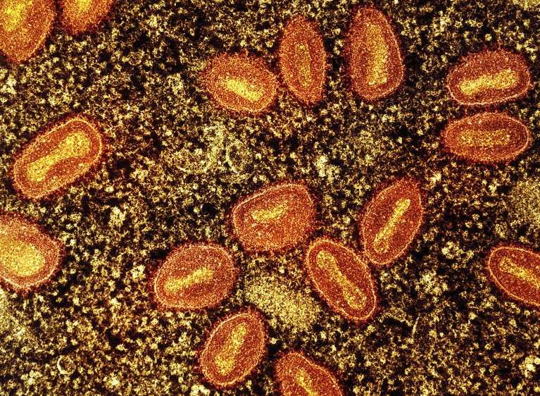 Coloured transmission electron micrograph of mpox (previously monkeypox) virus particles (orange) within an infected cell (yellow).