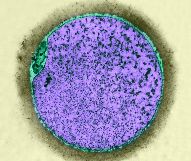 Light micrograph of a human oocyte in follicle, at completion of the first meiotic division.