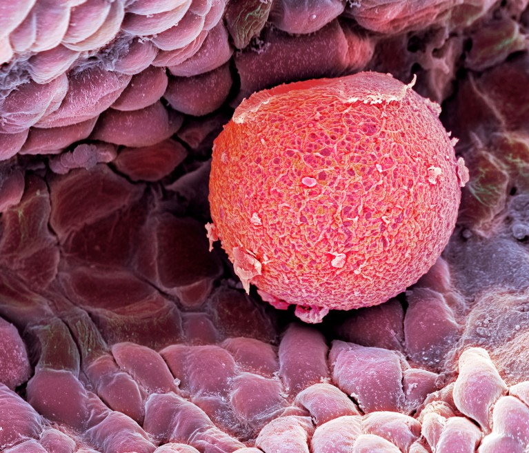 Coloured scanning electron micrograph of a human ovum shown in red in the fallopian tube