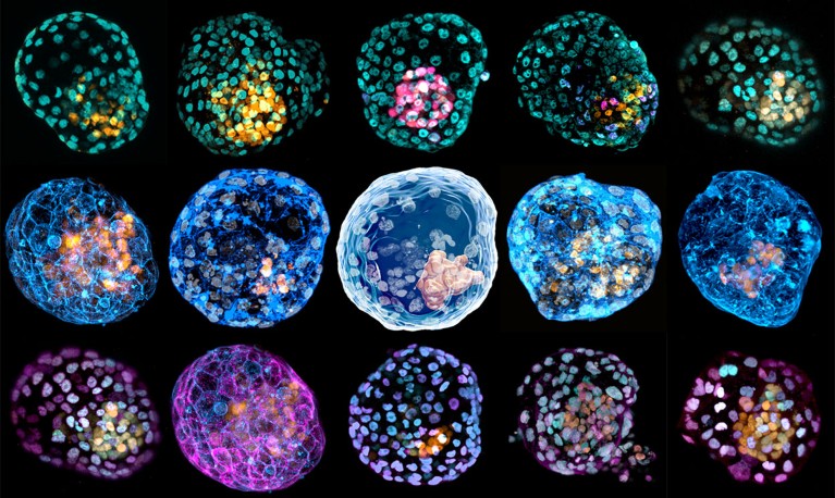 A composite image of fifteen images of iBlastoids with different cellular staining.