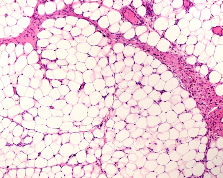 Light micrograph of white adipose tissue shown in pink and white colours.