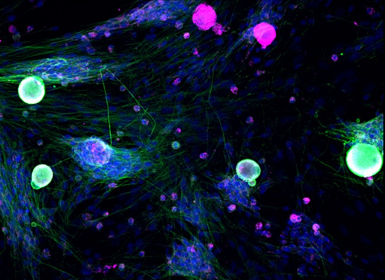 Colourful neuron image showing female prolactin receptors in green