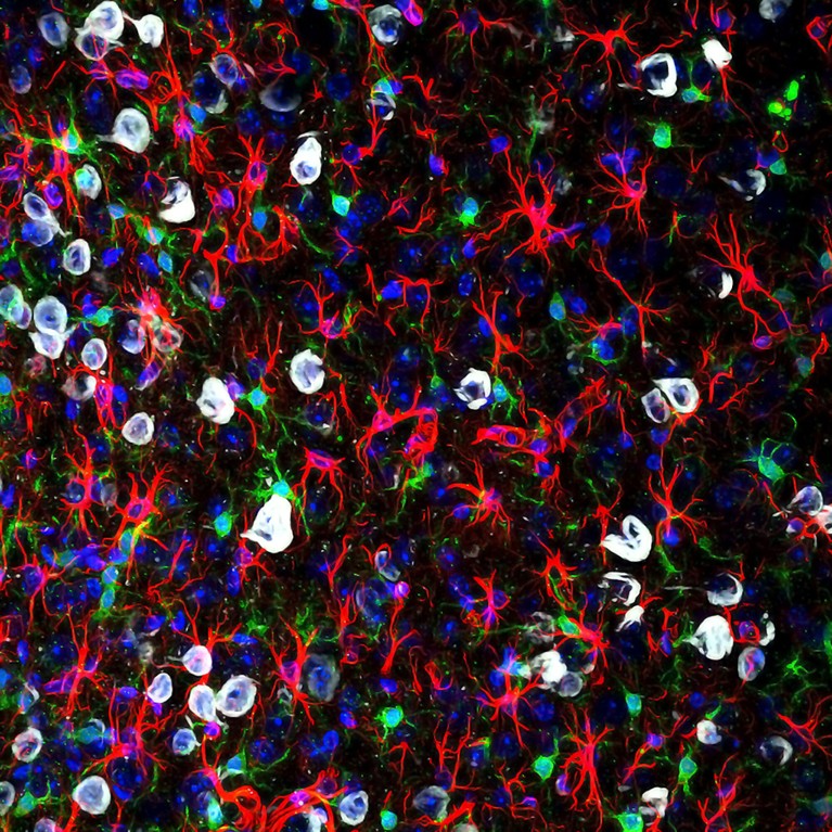 Hoescht stained colourful reactive region of cerebral cortex showing microglia in green.