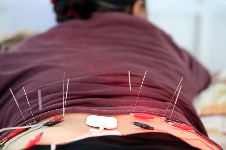 A woman lies on her front to receive electro acupuncture