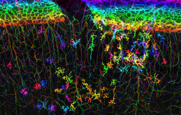 Microglia intertwined with tiny blood vessels, called micro vessels, in the primary somatosensory cortex of a 4-day-old mouse. Genetic labelling techniques and 3D.