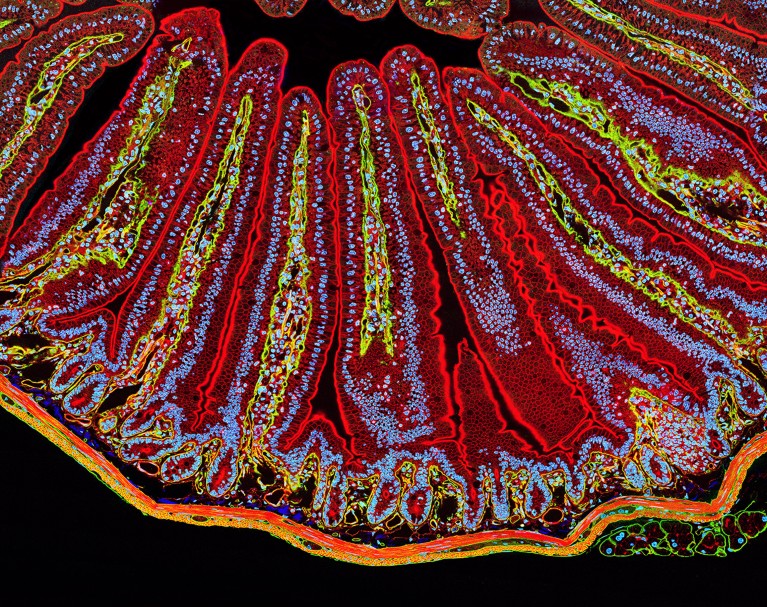 A fluorescent light micrograph of the small intestine.