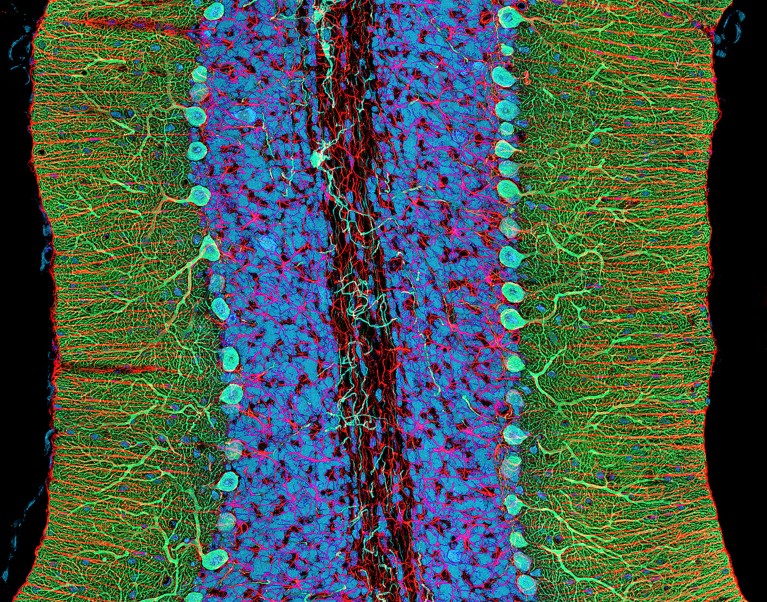 A luorescent micrograph of a section through the cerebellum of the brain showing Purkinje cells.