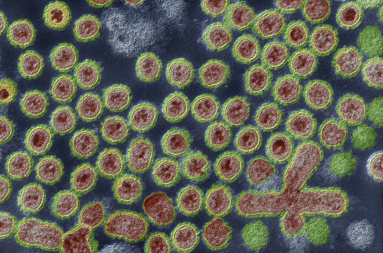 Avian influenza virus particles as a coloured transmission electron micrograph.