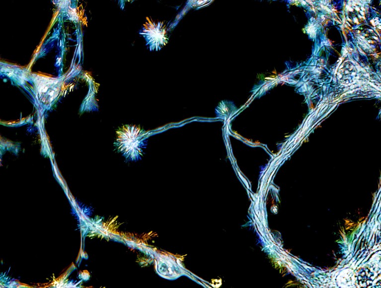 Light microscope image of neurons from the hippocampus on a black background.