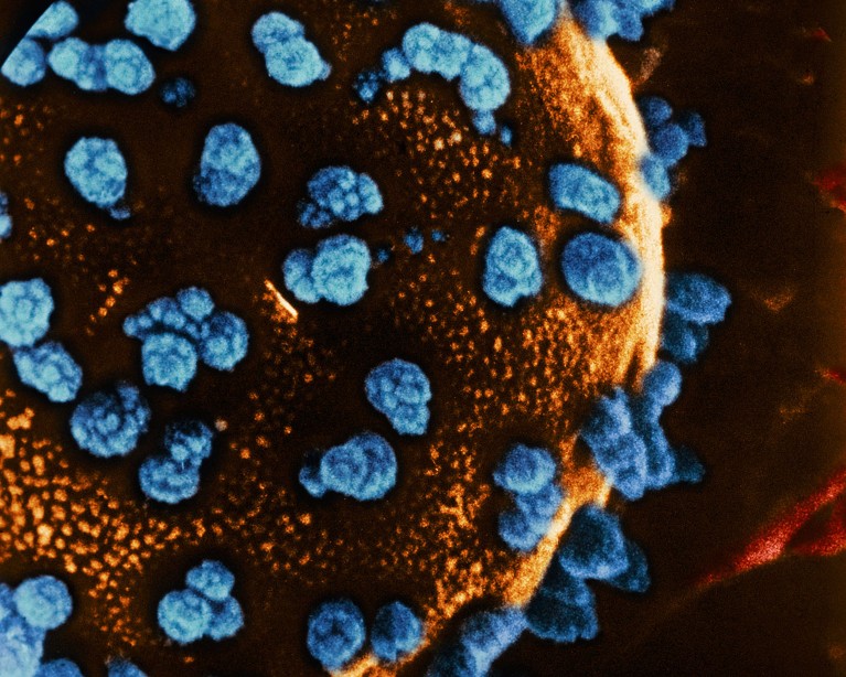 Colored scanning electron micrograph (SEM) of pancreatic islet cells.