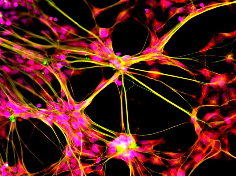 Fluorescent light micrograph of groups of neural stem cells shown in pink and yellow colours on a black background