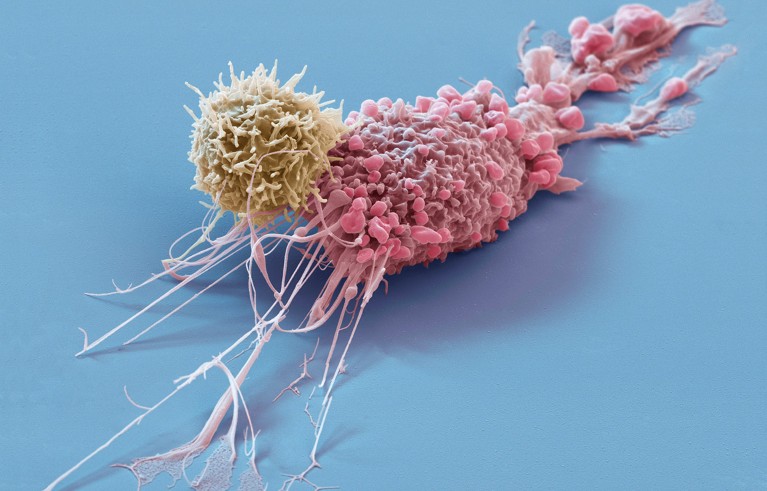 Coloured scanning electron micrograph of a breast cancer cell (pink) being attacked by a chimeric antigen receptor (CAR) T-cell (yellow).