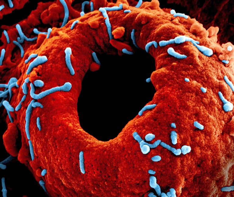 Coloured scanning electron micrograph (SEM) of Marburg virus particles (blue), both budding and attached, to the surface of an infected cultured cell (red).