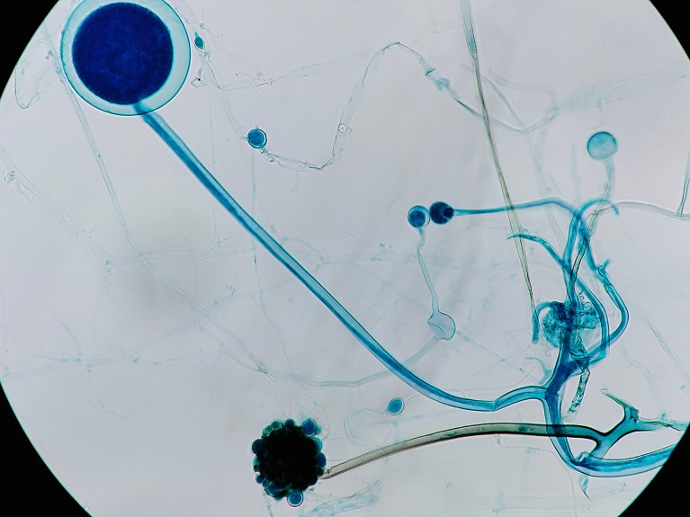 A sample of Rhizopus fungus under a microscope.