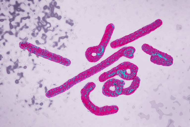 A transmission electron microscopy image of the Marburg virus, shown in bright pink and blue colours