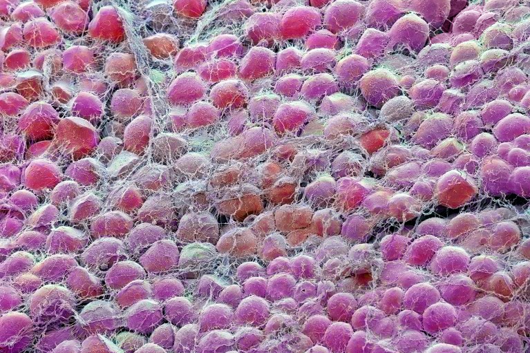 Coloured scanning electron micrograph of fat cells shown in various shades of pink