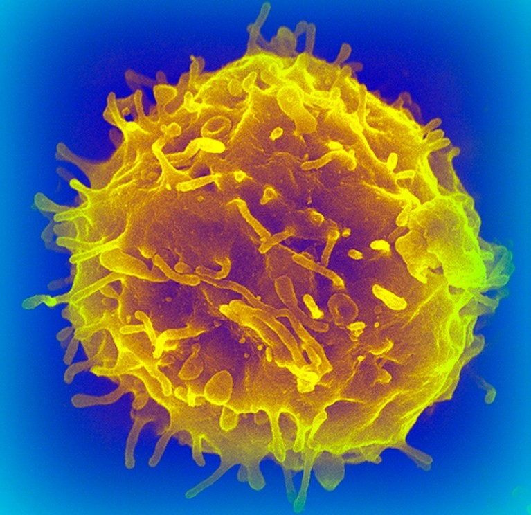 Coloured scanning electron micrograph of a haematopoietic stem cell.