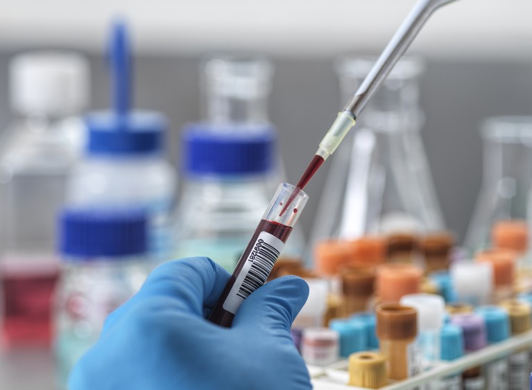 A close up of a laboratory technician pipetting a blood sample for analysis.