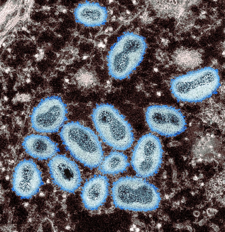 A transmission electron micrograph (TEM) showing mpox virus particles from a human sample.